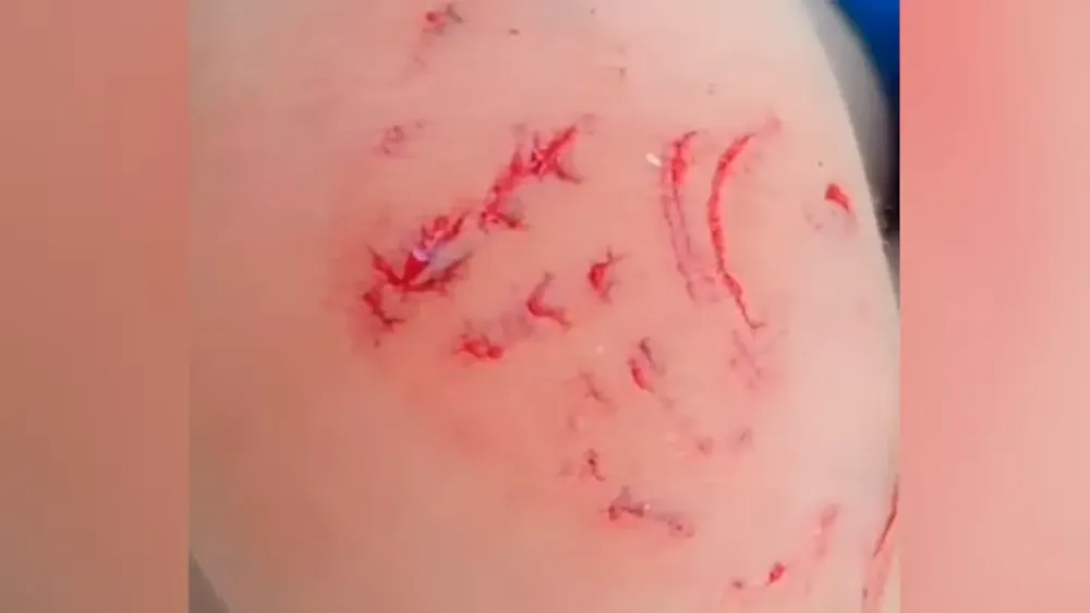 Tararira Attack