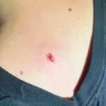 Nueva Córdoba: Dispararon balines «por diversión» desde un cuarto piso